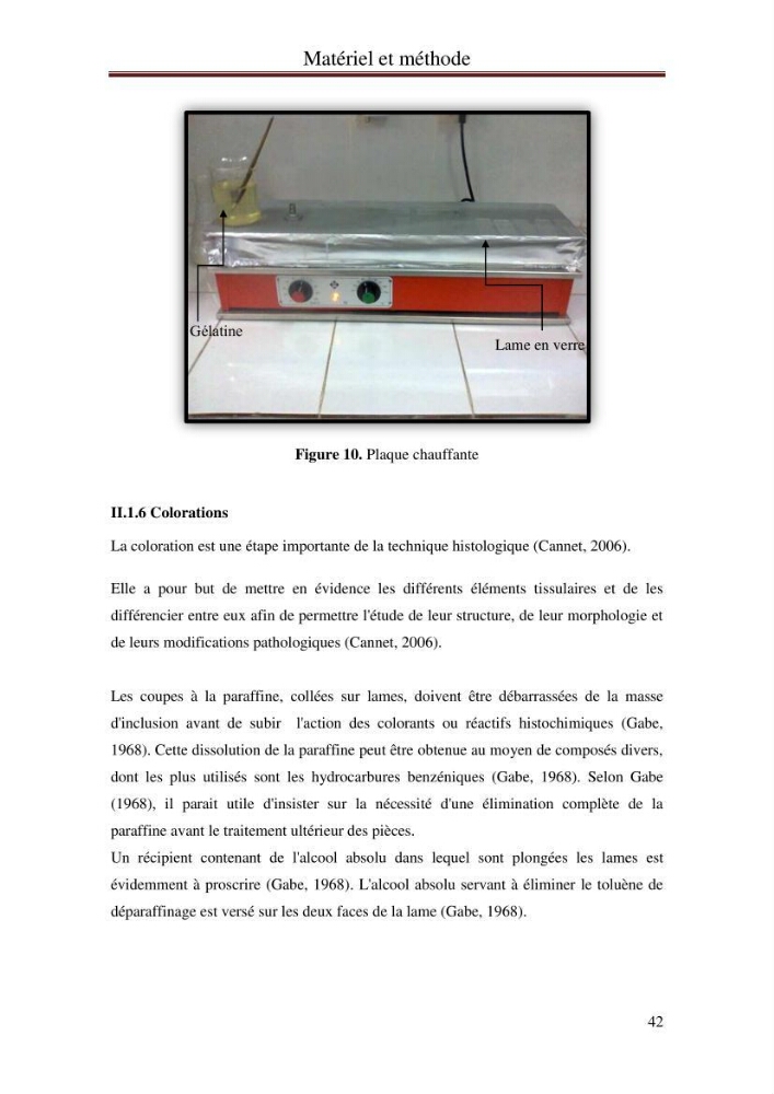 Mise en place d\'indicateurs écotoxicologiques pour la surveillance et l\'évaluation de la pollution marine (indice hépatique et gonadique des poissons)