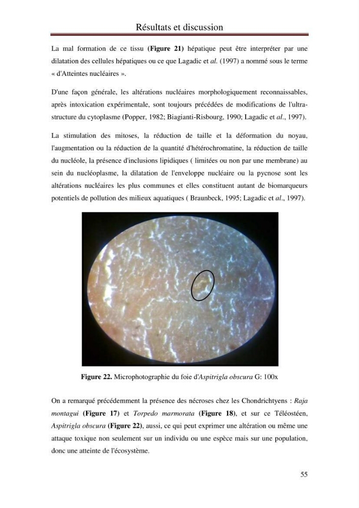 Mise en place d\'indicateurs écotoxicologiques pour la surveillance et l\'évaluation de la pollution marine (indice hépatique et gonadique des poissons)