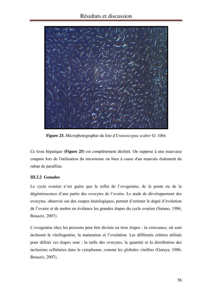 Mise en place d\'indicateurs écotoxicologiques pour la surveillance et l\'évaluation de la pollution marine (indice hépatique et gonadique des poissons)