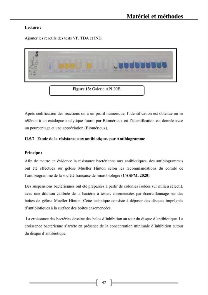 Caractérisation et évaluation de la résistance aux antibiotiques chez les entérocoques dans le milieu marin .