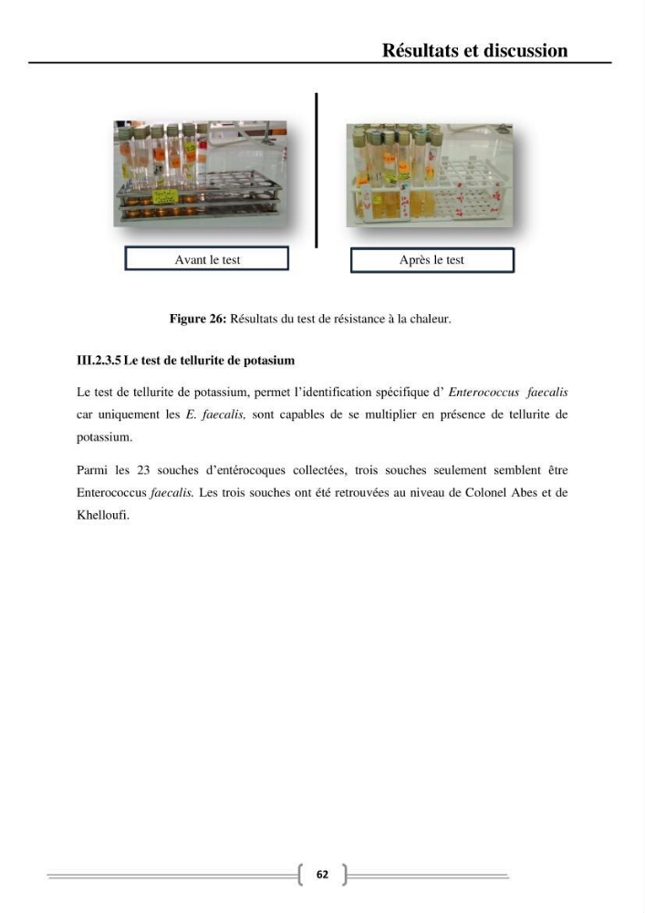 Caractérisation et évaluation de la résistance aux antibiotiques chez les entérocoques dans le milieu marin .