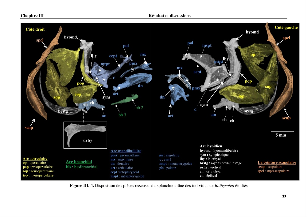 Contribution à l\'étude systématique du genre Bathysolea Roule,1916 (Pleuronnectiformes, Soleidae) des côtes Algeriennes: études morphométriques et ostéologique