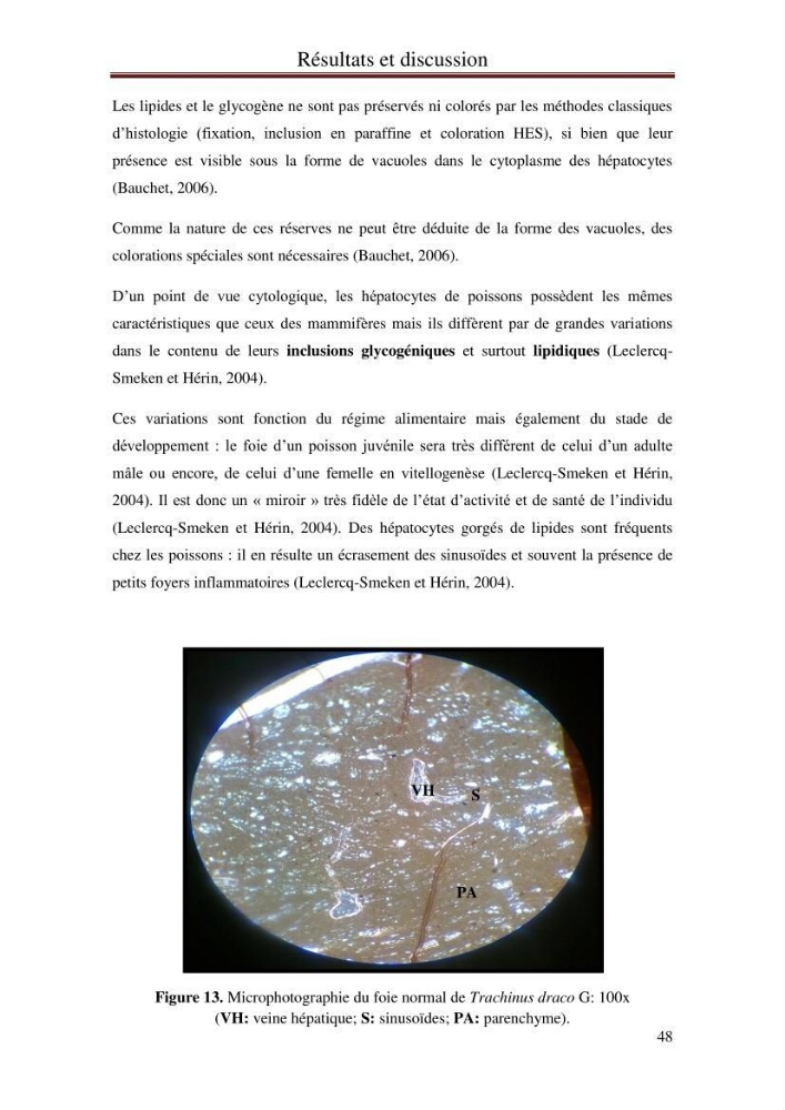 Hydrologie, modélisation hydro-sédimentaire et conception des ouvrages de protection : cas de la baie de Béjaia: