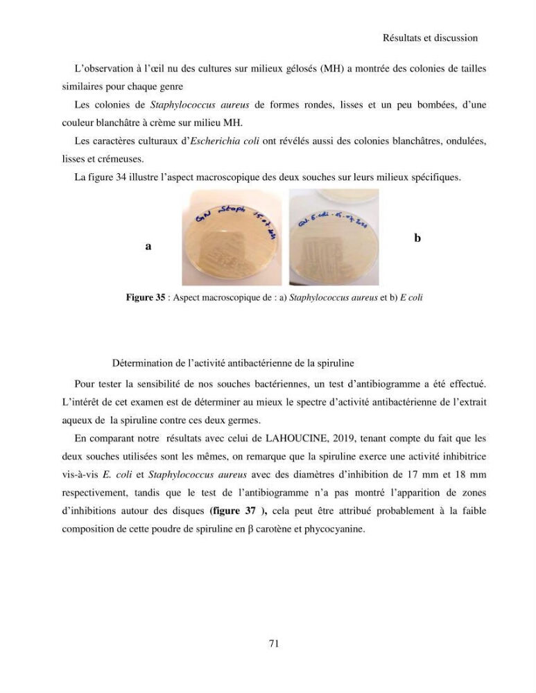 Extraction et identification des pigments de micro-algues à usage alimentaire et pharmaceutique