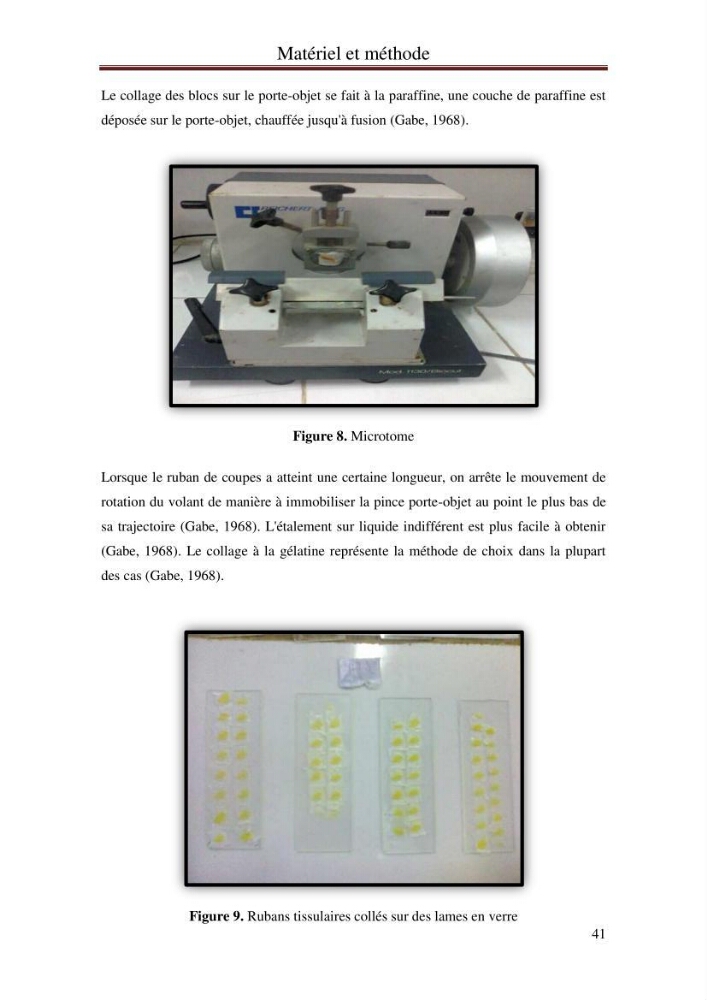 Mise en place d\'indicateurs écotoxicologiques pour la surveillance et l\'évaluation de la pollution marine (indice hépatique et gonadique des poissons)