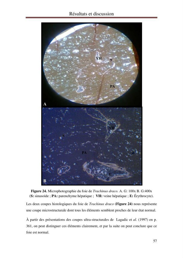 Mise en place d\'indicateurs écotoxicologiques pour la surveillance et l\'évaluation de la pollution marine (indice hépatique et gonadique des poissons)