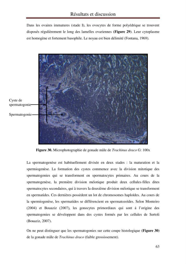 Mise en place d\'indicateurs écotoxicologiques pour la surveillance et l\'évaluation de la pollution marine (indice hépatique et gonadique des poissons)
