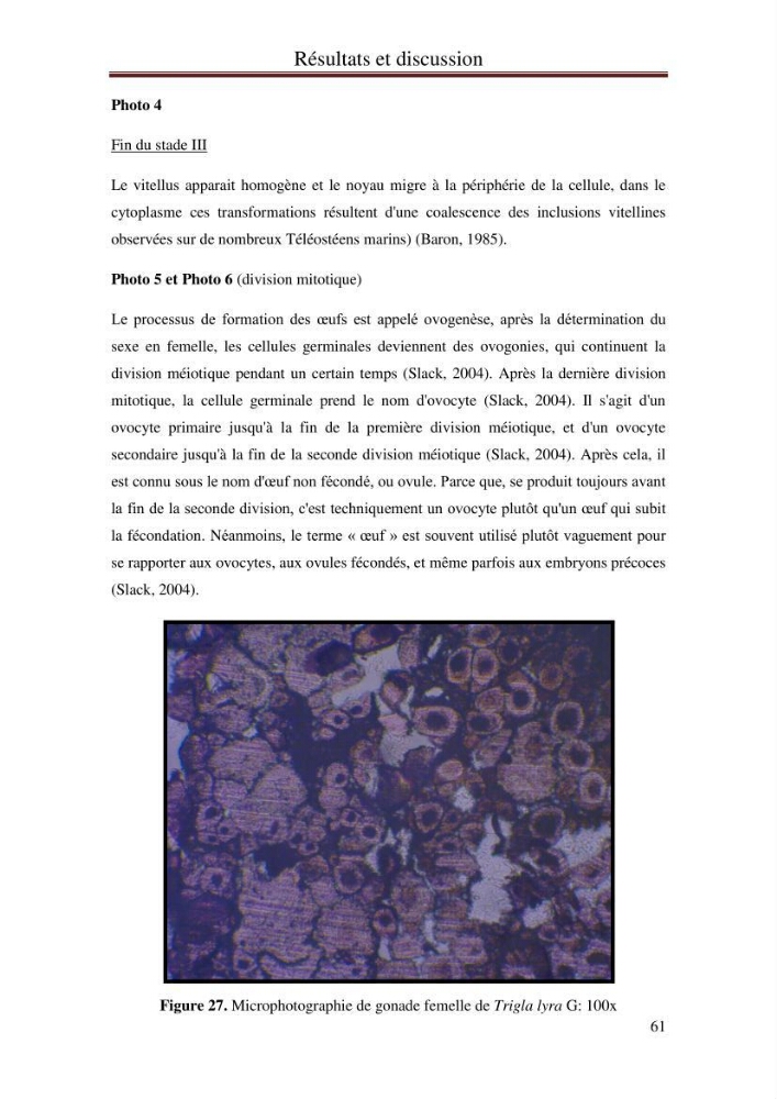Mise en place d\'indicateurs écotoxicologiques pour la surveillance et l\'évaluation de la pollution marine (indice hépatique et gonadique des poissons):