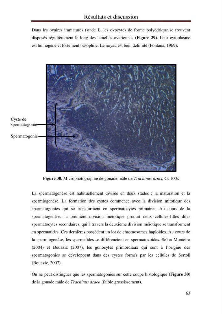 Mise en place d\'indicateurs écotoxicologiques pour la surveillance et l\'évaluation de la pollution marine (indice hépatique et gonadique des poissons):