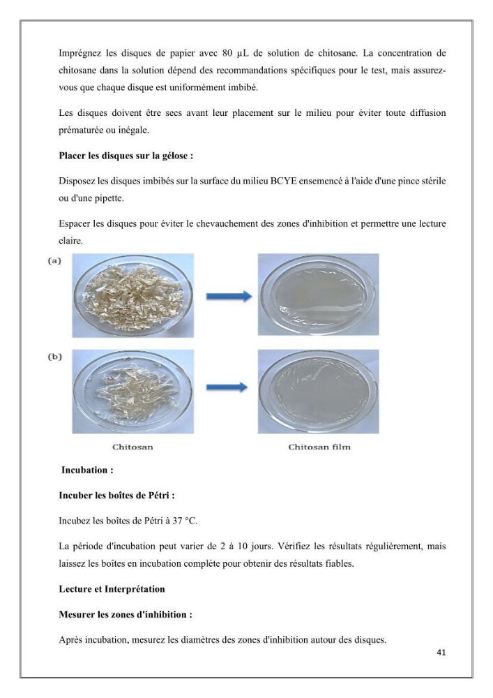 Élaboration et caractérisation de pansements innovants à base de chitosane marin.
