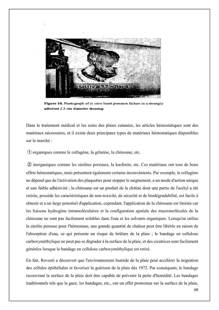Élaboration et caractérisation de pansements innovants à base de chitosane marin.