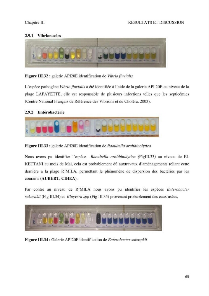 Suivi de la qualité microbiologique et physicochimique des eaux de baignade.