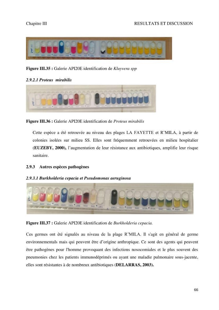 Suivi de la qualité microbiologique et physicochimique des eaux de baignade.