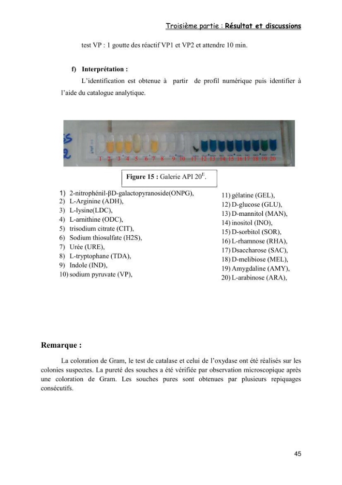 Evaluation de la qualité microbiologique de filets congelé du Panda (Pangaisius hypophthamus)