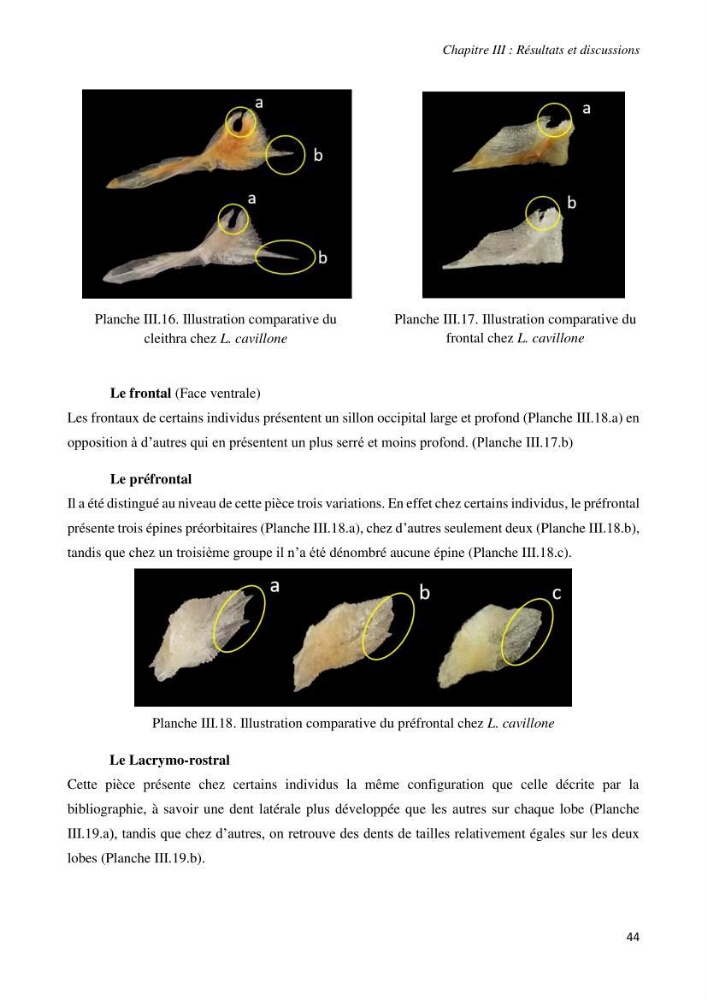 Contribution à l’étude de la systématique de la famille des Triglidae (Ostéichtyens, Actinoptérygiens) du bassin algérien