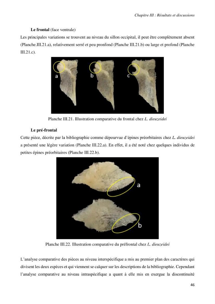Contribution à l’étude de la systématique de la famille des Triglidae (Ostéichtyens, Actinoptérygiens) du bassin algérien