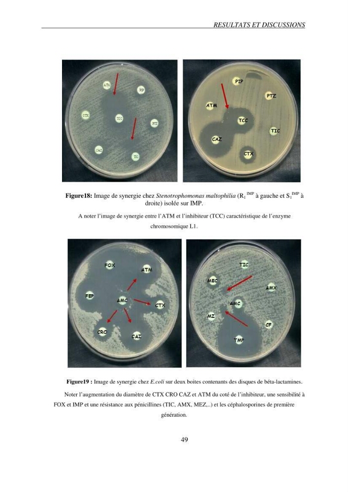 Prévalence et caractérisation de la résistance aux béta-lactamines chez des bactéries de l\'environnement marin