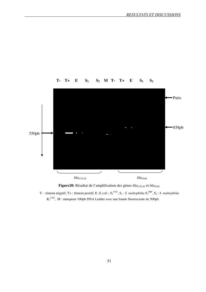 Prévalence et caractérisation de la résistance aux béta-lactamines chez des bactéries de l\'environnement marin