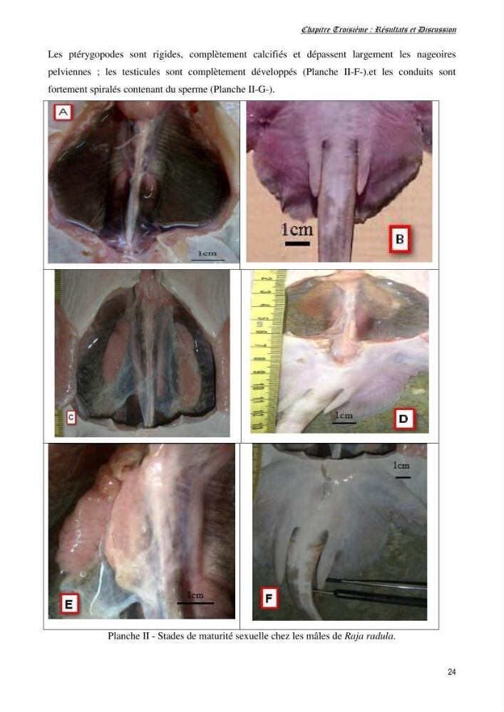 Contribution à l’étude de la biologie, de la croissance et de l’exploitation de Raja radula (Elasmobranches, Rajidae) dans la région Est du bassin algérien