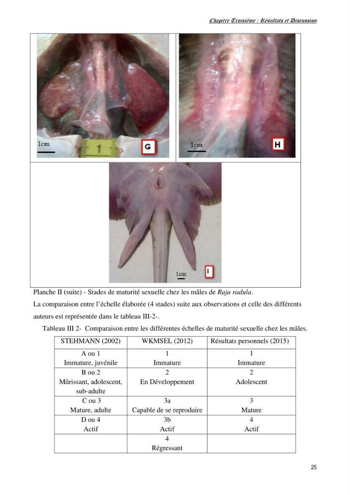 Contribution à l’étude de la biologie, de la croissance et de l’exploitation de Raja radula (Elasmobranches, Rajidae) dans la région Est du bassin algérien