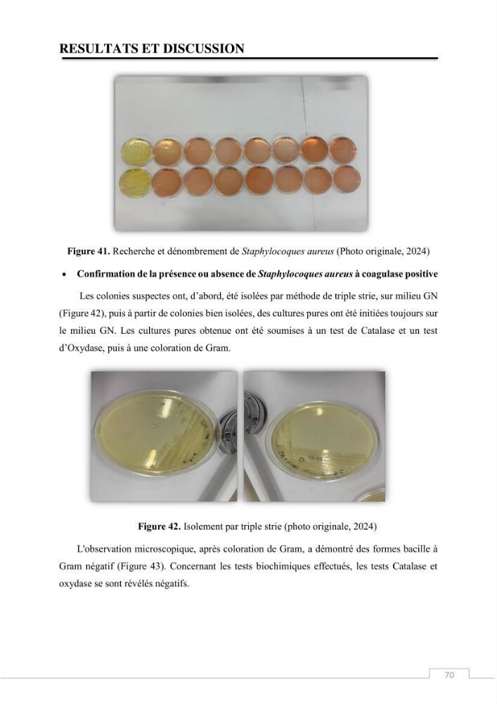 Valorisation des déchets issus de la pêche, après transformation par voie Biotechnologique
