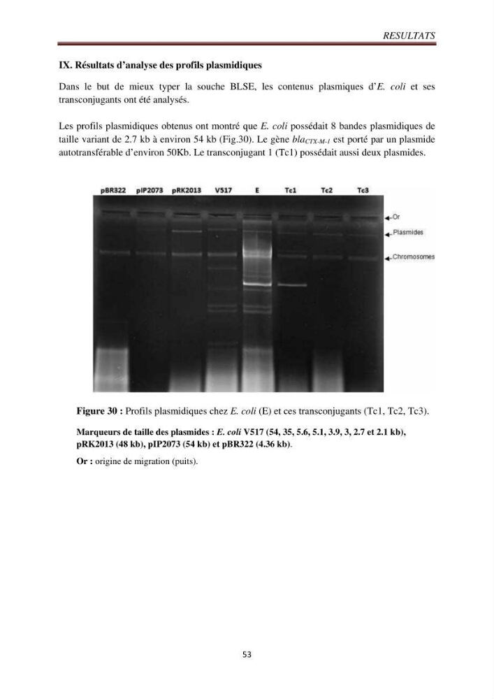 Détection de la résistance bactérienne aux antibiotiques dans l\'environnement marin, influence des apports anthropiques