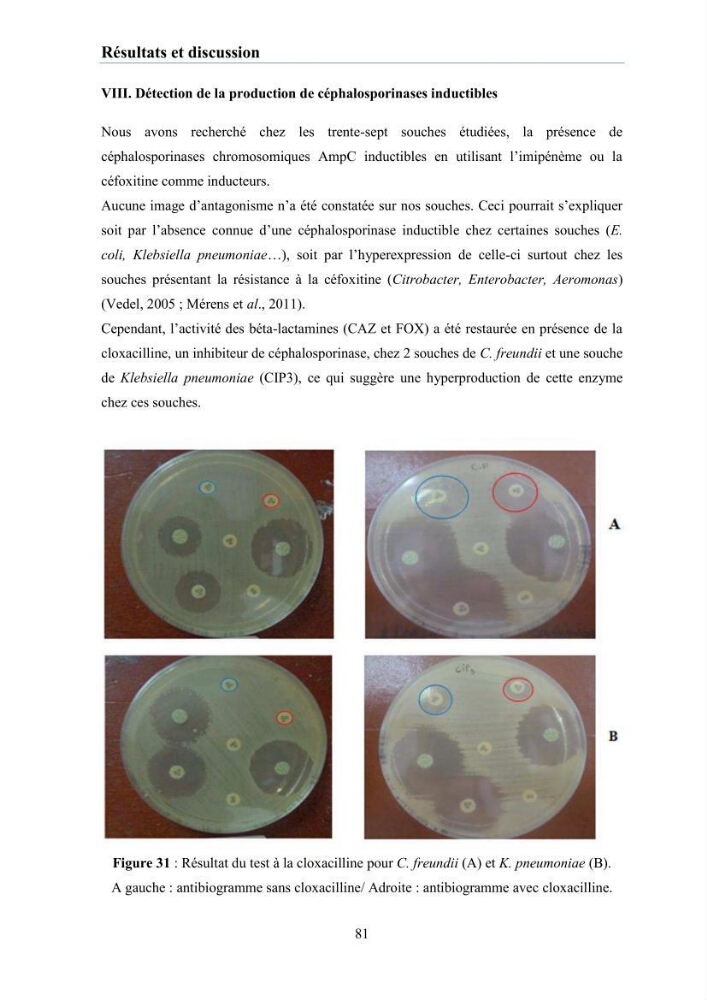 Evaluation et caractérisation de la résistance aux antibiotiques chez des bactéries à Gram négatif isolées à partir de milieux et d’animaux aquatiques