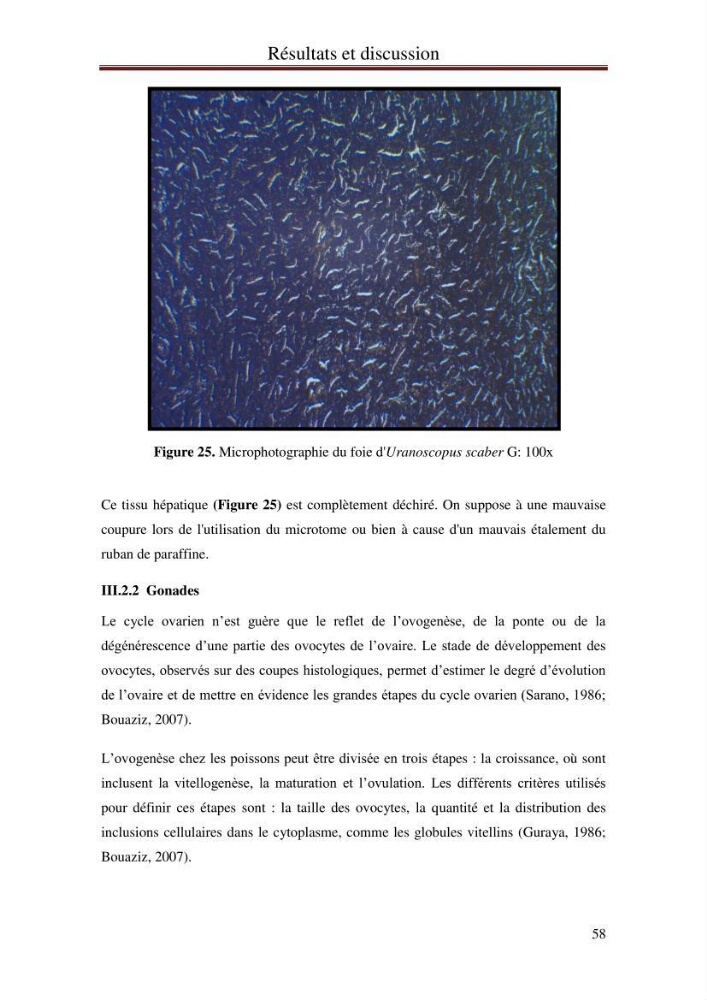 Impact de l’élévation de niveau de la mer et des tempêtes sur l’évolution morpho dynamique de la région Est de la baie d’Alger : simulation numérique des processus hydro-sédimentaires.: